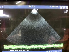 Ultrasound system(Color)｜SSD-4000SV｜Aloka photo3