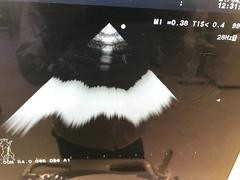 Ultrasound system(Color)｜ProSound α7｜Hitachi photo3