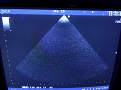 Ultrasound system(Color)｜SSD-4000｜Aloka photo3