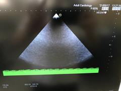 Ultrasound system(Color)｜HI VISION Avius｜Hitachi photo20