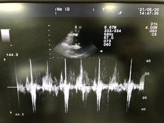 Ultrasound system｜F37｜Hitachi photo20