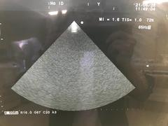 Ultrasound system(Color)｜ProSound α7｜Hitachi photo19