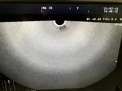Ultrasound system｜F37｜Hitachi photo17