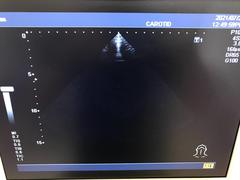 Ultrasound system(Color)｜SSA-580A Nemio XG｜Canon Medical Systems photo20