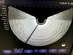 Ultrasound system｜SONOVISTA FX｜Mochida Siemens Medical Systems photo3