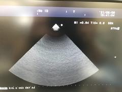 Ultrasound system｜F37｜Hitachi photo3