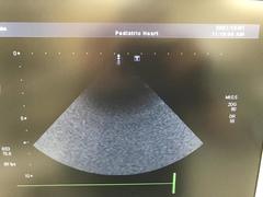 Ultrasound system(Color)｜SSA-660A Xario(LCD)｜Canon Medical Systems photo23