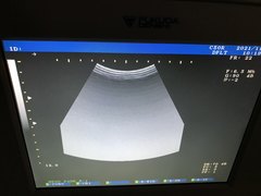Ultrasound system(Color)｜UF-750XT｜Fukuda photo3