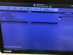 超音波診断装置｜LOGIQ S7 with XDclear｜GEヘルスケアの写真23枚目