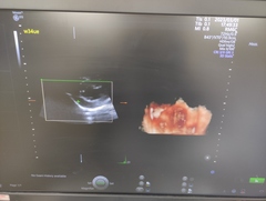 Ultrasound system(Color)｜Voluson E10｜GE Healthcare photo23