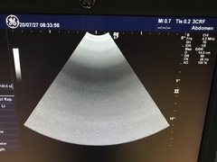 Ultrasound system(Color)｜LOGIQ 7｜GE Healthcare photo24