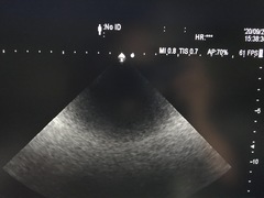 超音波診断装置｜ARIETTA S70｜日立製作所の写真20枚目