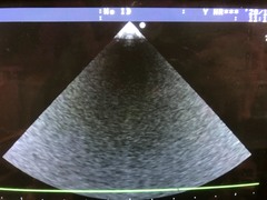 Ultrasound system(Color)｜SSD-3500SV｜Aloka photo3