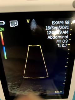 Ultrasound system(Color)｜Vscan｜GE Healthcare photo8
