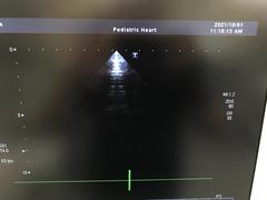 Ultrasound system(Color)｜SSA-660A Xario(LCD)｜Canon Medical Systems photo24