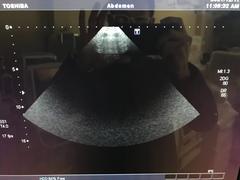 超音波診断装置（カラードプラ）｜SSA-680A XarioXG｜キヤノンメディカルシステムズの写真20枚目