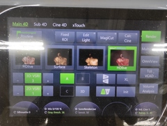 4D超音波診断装置（カラードプラ）｜Voluson E10｜GEヘルスケアの写真24枚目